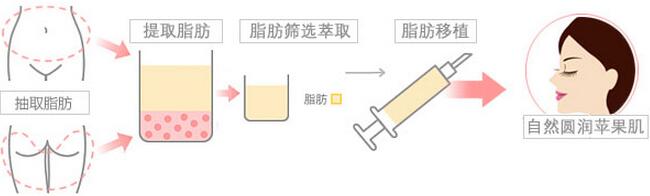 丰苹果肌的方法